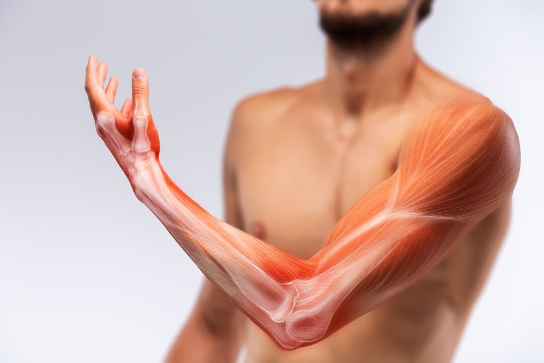 Os músculos das mans e o seu tratamento con Congelum -GEL TRATAMENTO
